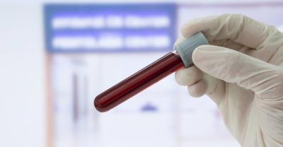 Un nouveau test sanguin pour diagnostiquer la maladie d’Alzheimer est en cours de développement. (Photo via X.) Un nouveau test sanguin pour diagnostiquer la maladie d’Alzheimer est en cours de développement. (Photo via X.)
